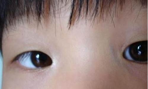 黑眼珠变小了怎么恢复(如何让眼睛变大变有神)_https://www.luoxuangg888.com_北交所_第1张